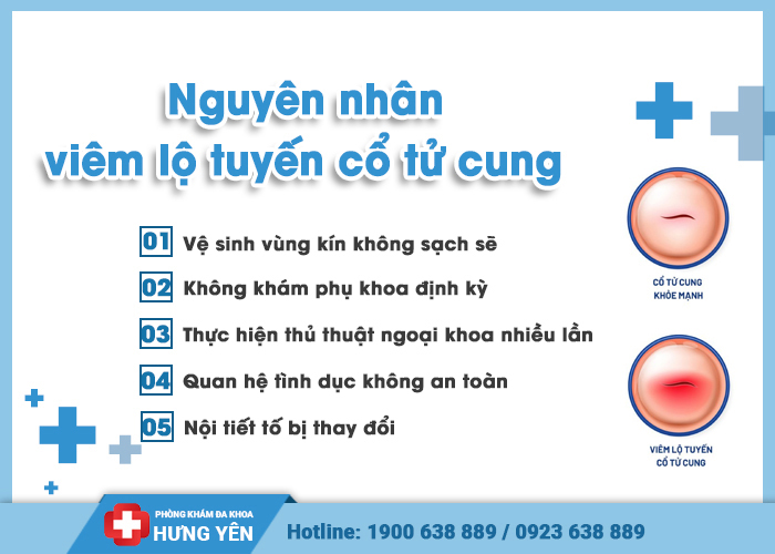 nguyên nhân bị bệnh viêm lộ tuyến cổ tử cung