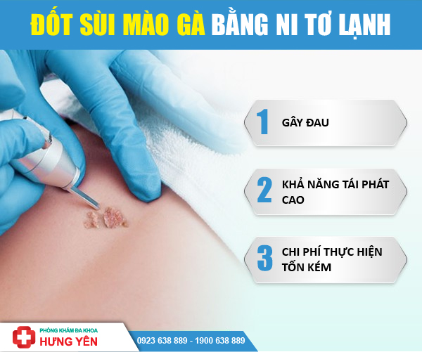 đốt sùi mào gà bằng ni tơ lạnh