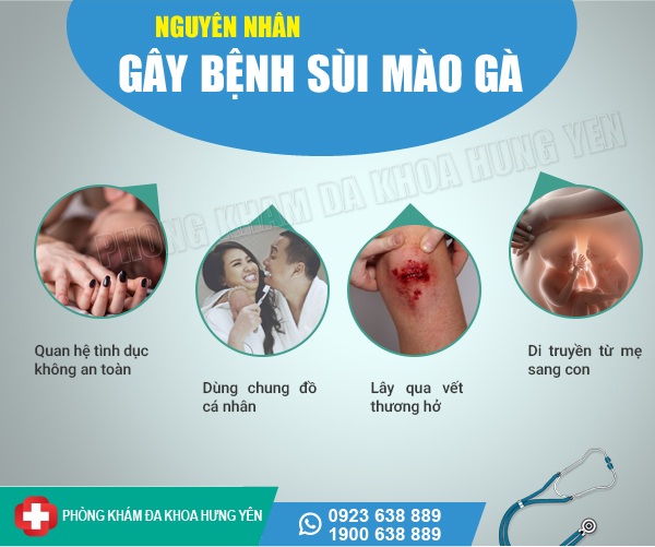 nguyên nhân gây bệnh sùi mào gà