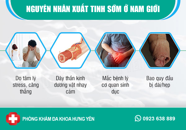 nguyên nhân gây xuất tinh sớm - tại sao đàn ông quan hệ nhanh ra là đây