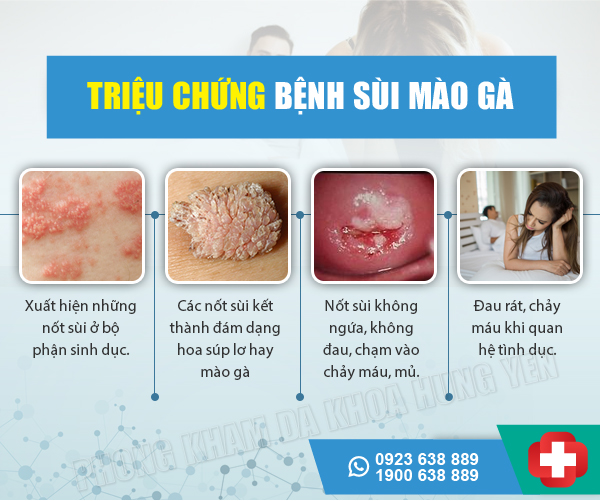 dấu hiệu triệu chứng của bệnh sùi mào gà