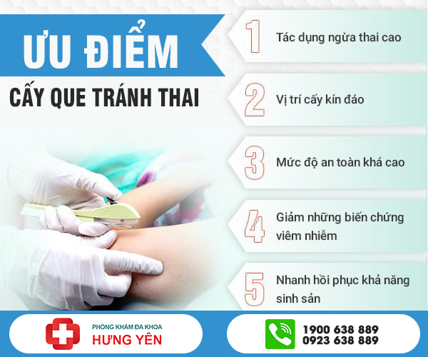 ưu điểm của cấy que tránh thai