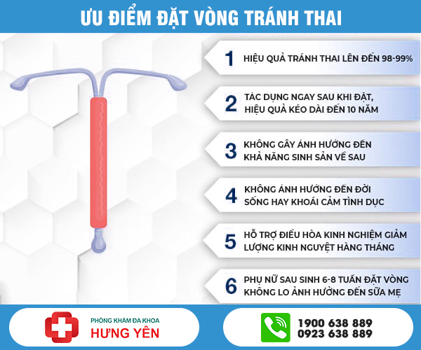 ưu điểm của đặt vòng tránh thai ở hưng yên