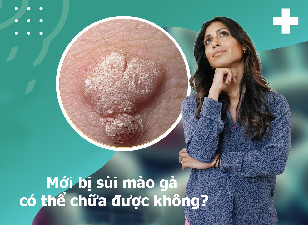 Mới bị sùi mào gà có thể chữa được không?